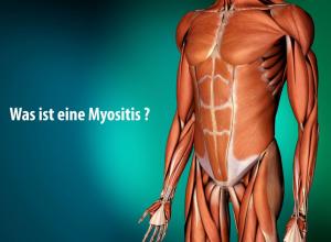 myositis_Video